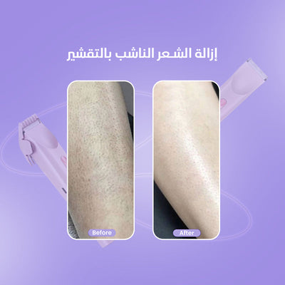 2-in-1 Women's Body Shaver ماكينة حلاقة نسائية 2 في 1 للجسم